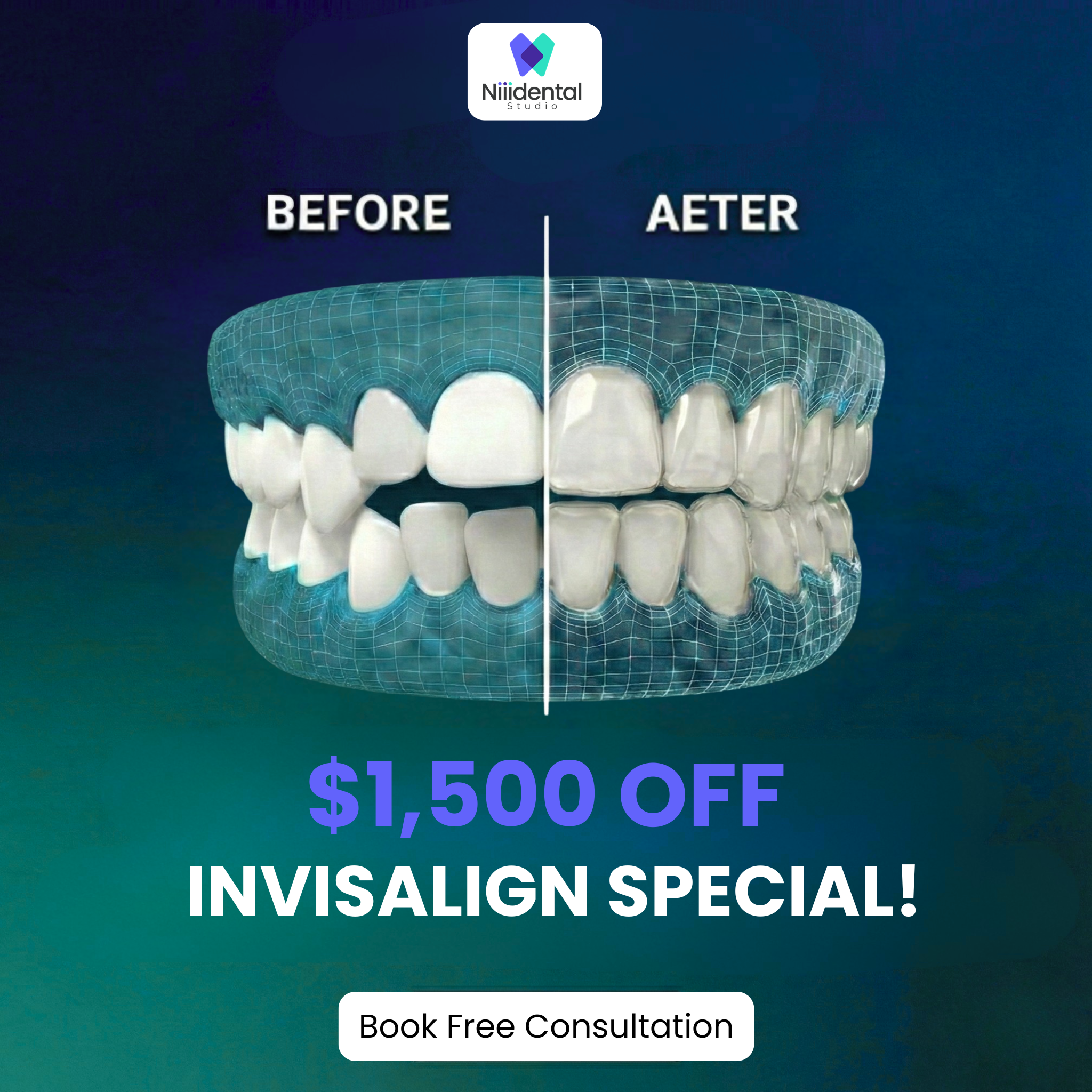 Niiidental Studio Facebook ad: Hey McKinney! Spring Special $1500 OFF Invisalign Treatment!