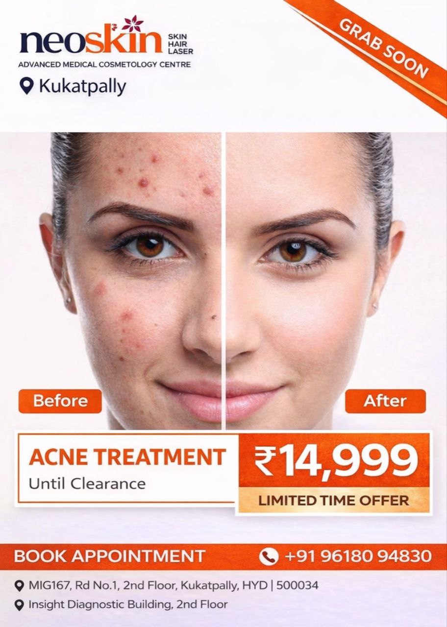 Neo Skin Clinic KPHB Facebook ad: Acne Treatment @ ₹14,999, Limited Offer