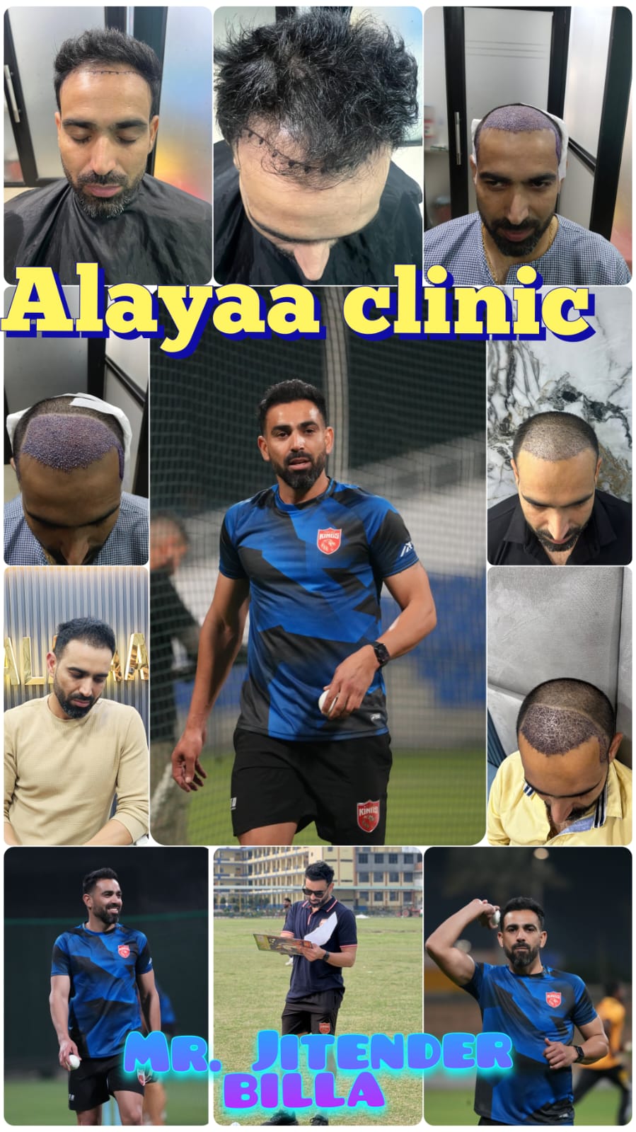 Alayaa Hair Transplant Clinic Facebook ad from May 21, 2026