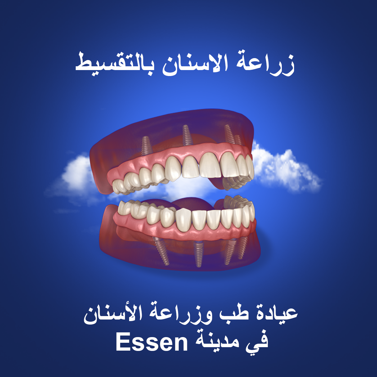 Merci Dent Zahnarztpraxis Facebook ad: اتصل الآن ورتب استشارة مجانية