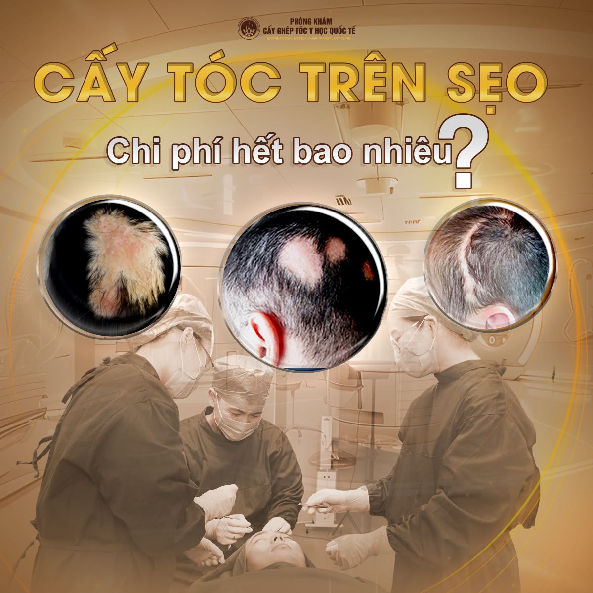 Cấy tóc tự thân Y học Quốc tế Hair Transplant - HCM Facebook ad: Inbox Ngay để được BS Chuyên khoa tư vấn 1:1 Xác định…