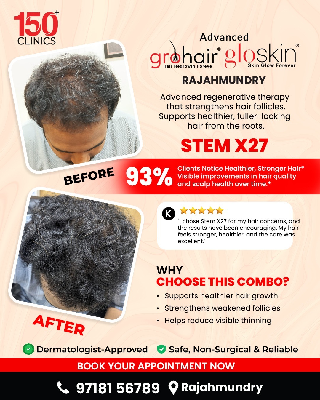 Adgrohairclinicrajahmundry Facebook ad