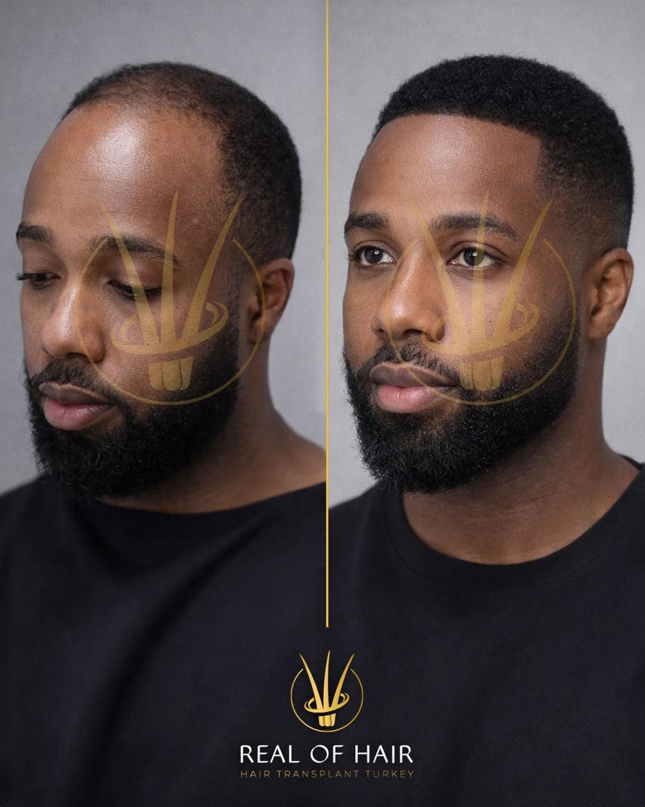 Real Of Hair Facebook ad