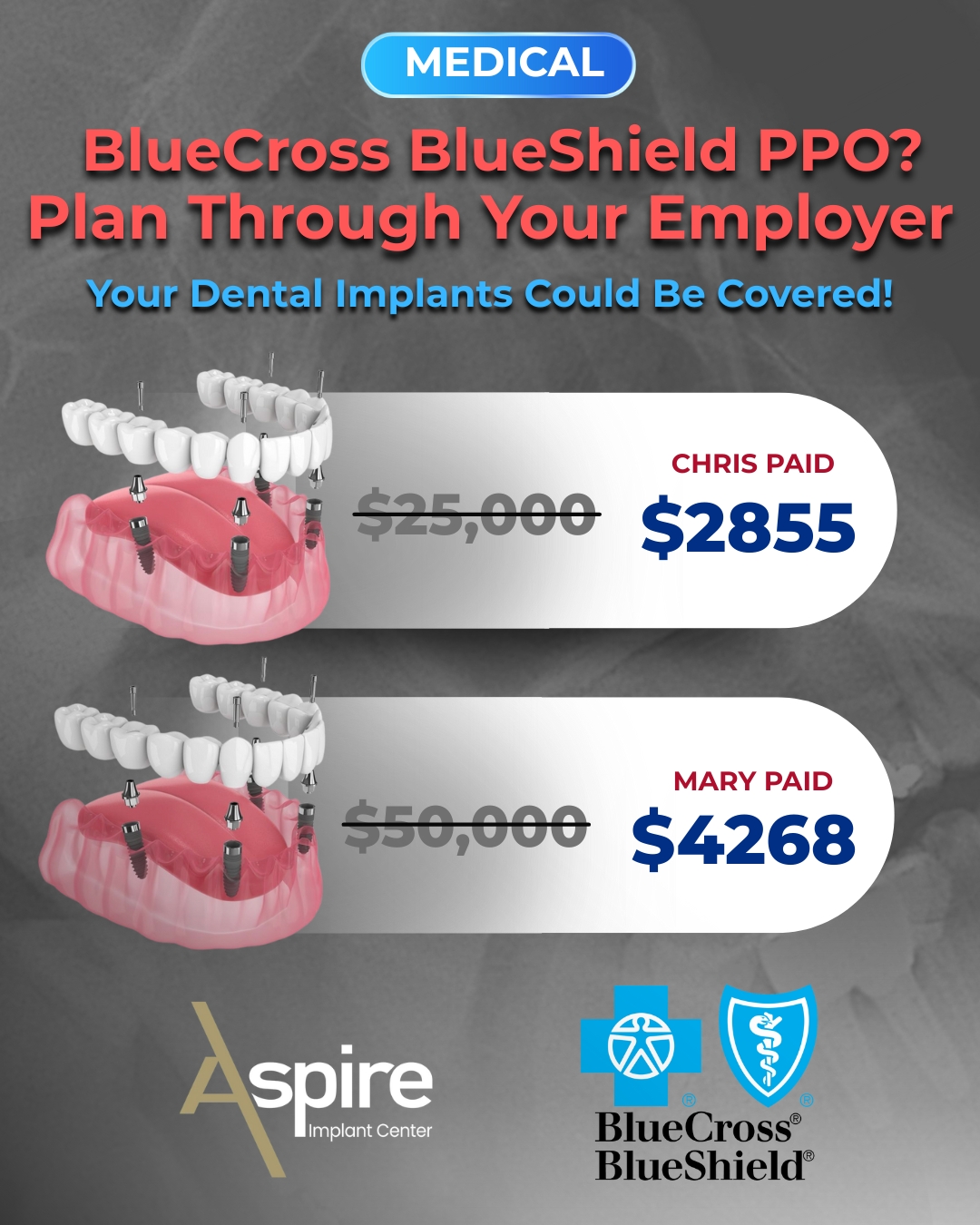 Aspire Dental Implant Facebook ad: SAVE BIG - Learn more