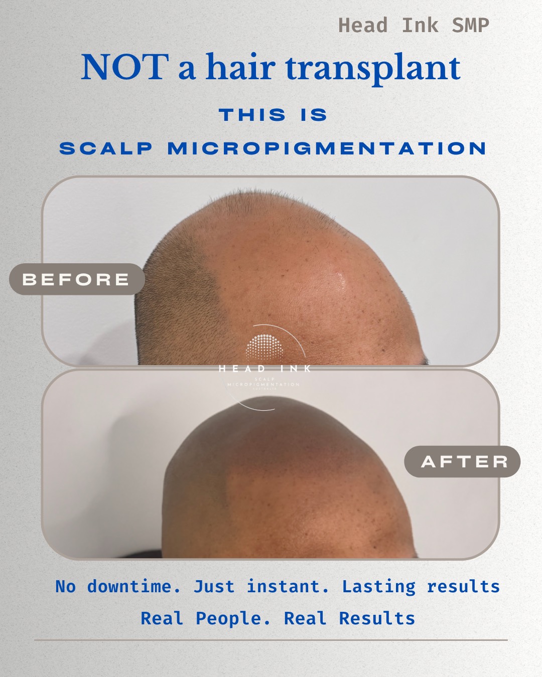Head Ink SMP Melbourne Facebook ad