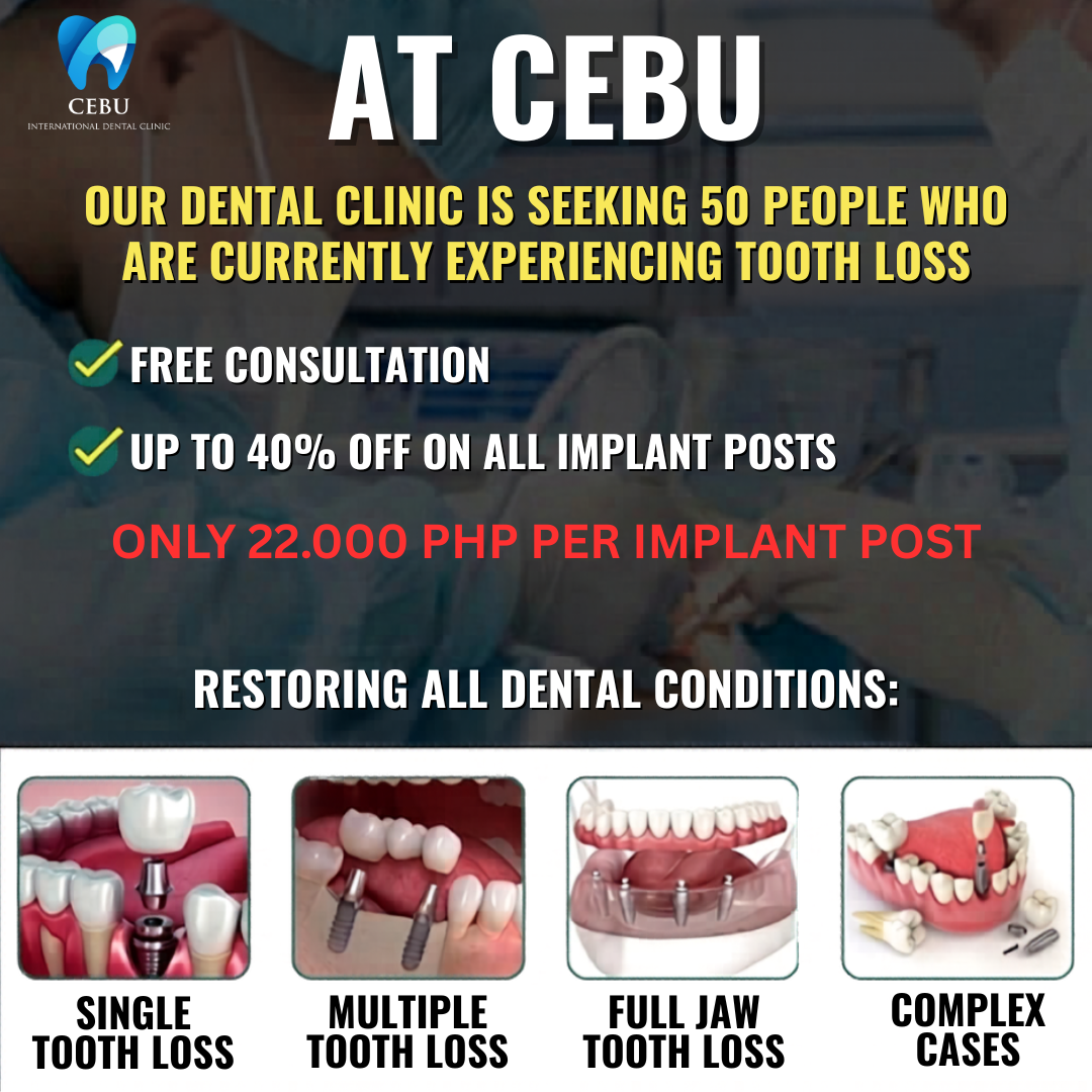 CEBU Dental Aesthetic Facebook ad: ONLY 22,000 PHP PER IMPLANT