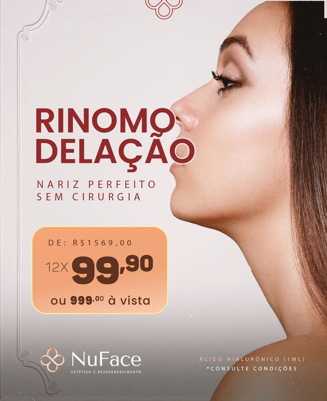 NuFace Uberlândia Facebook ad from Feb 1, 2026