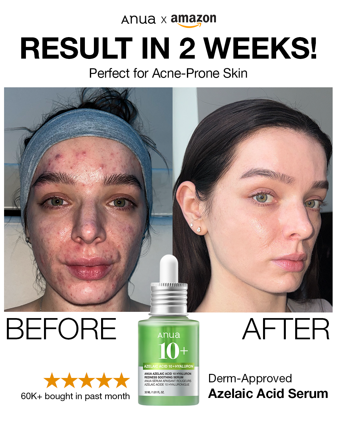ANUA_Global Facebook ad