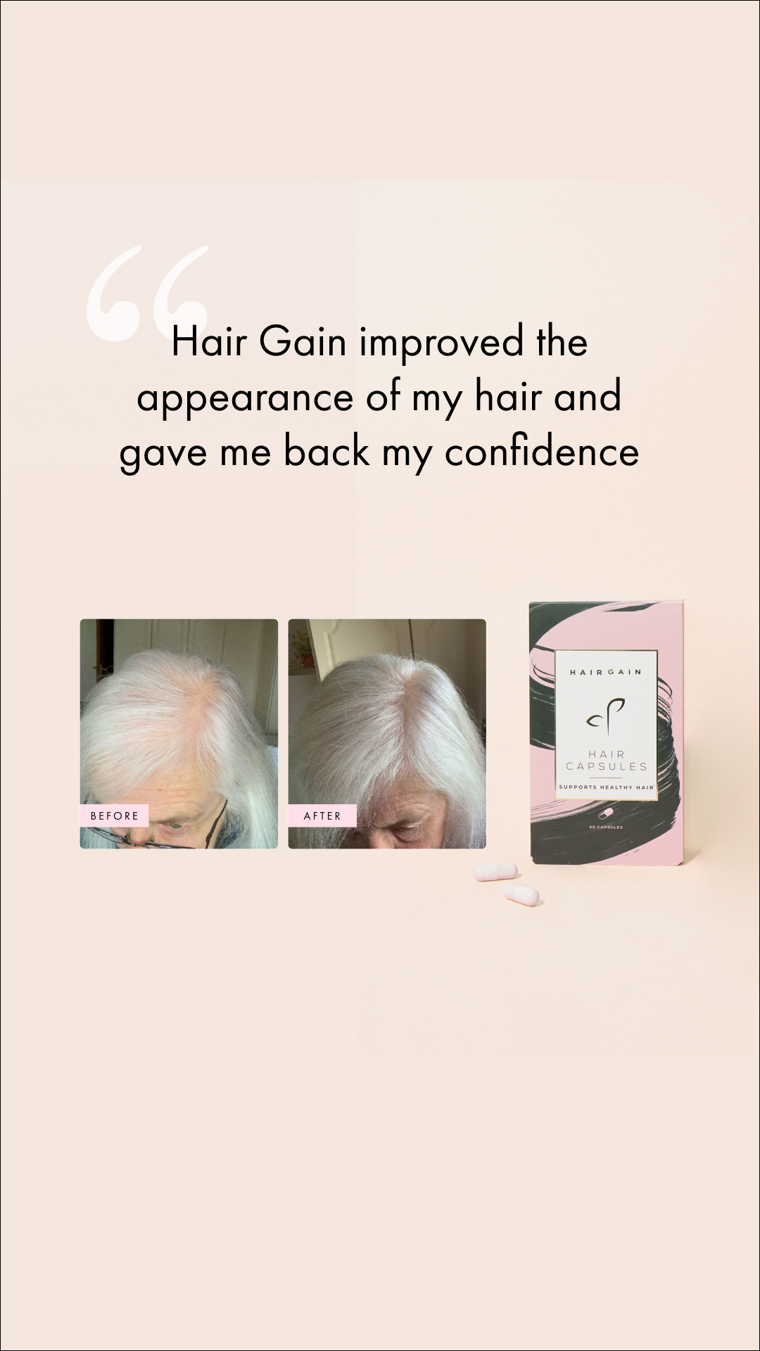 Hair Gain Facebook ad