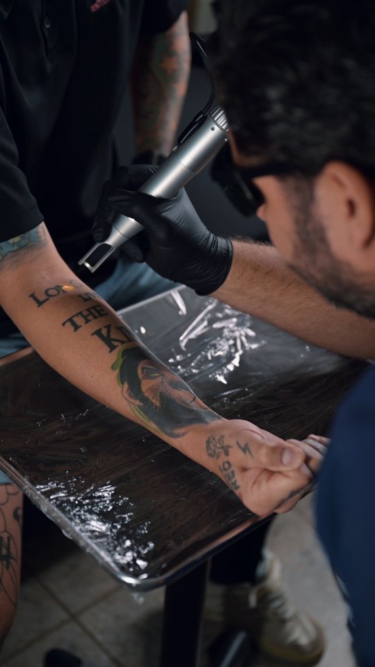 Neodermis PR Facebook ad: ¿Pensando en remover un tatuaje?