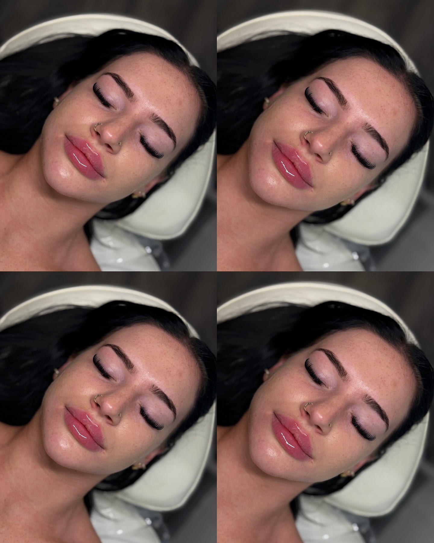 Adorabelle - Laser Hair Removal, Aesthetics, Carbon Facials Facebook ad: Russian Lips, Defined, Lifted, Beautiful