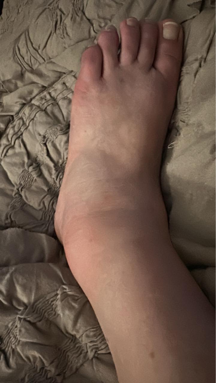Tina Cooper Facebook ad: My feet were so swollen by evening I couldn’t get my shoes…