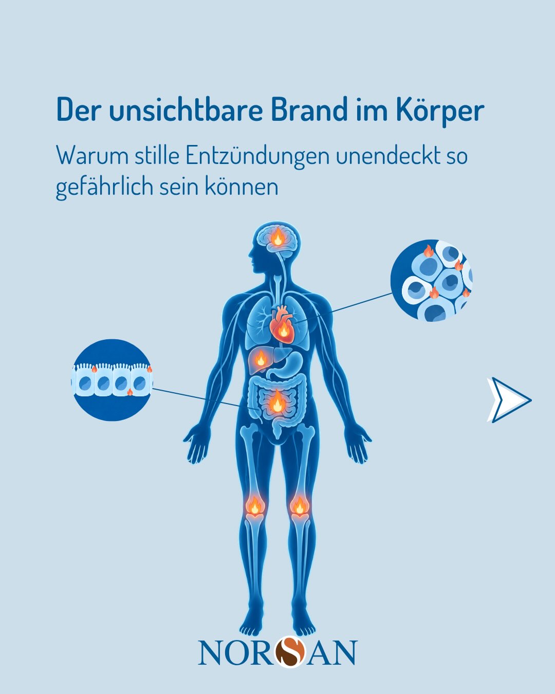 NORSAN Facebook ad