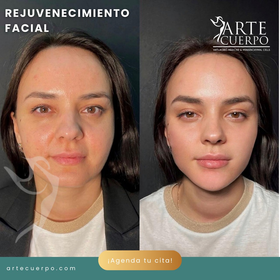 Clinica spa arte cuerpo  Facebook ad