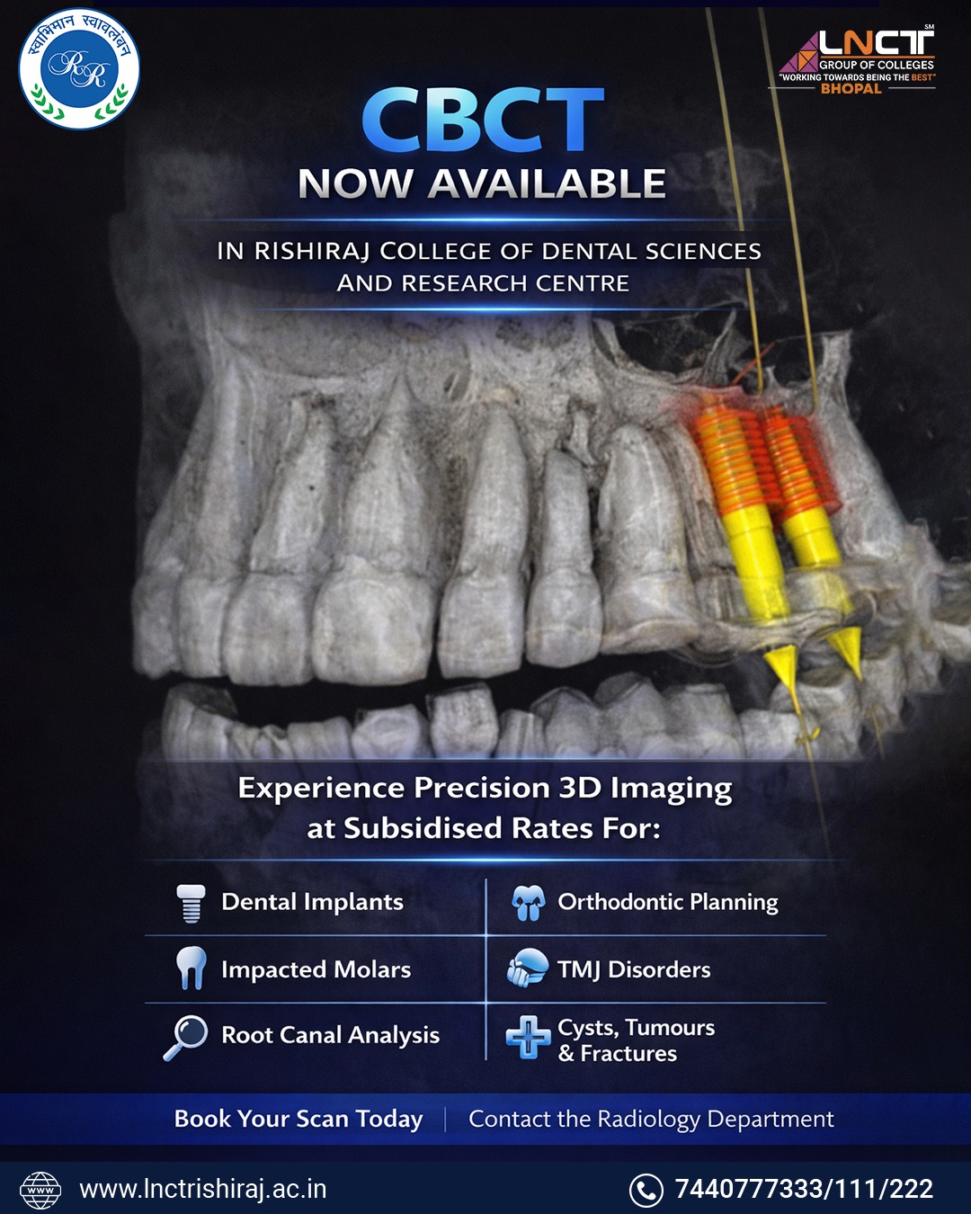 Rishiraj College of Dental Sciences and Research Centre, Bhopal Facebook ad: CBCT 3D Scan Now Available