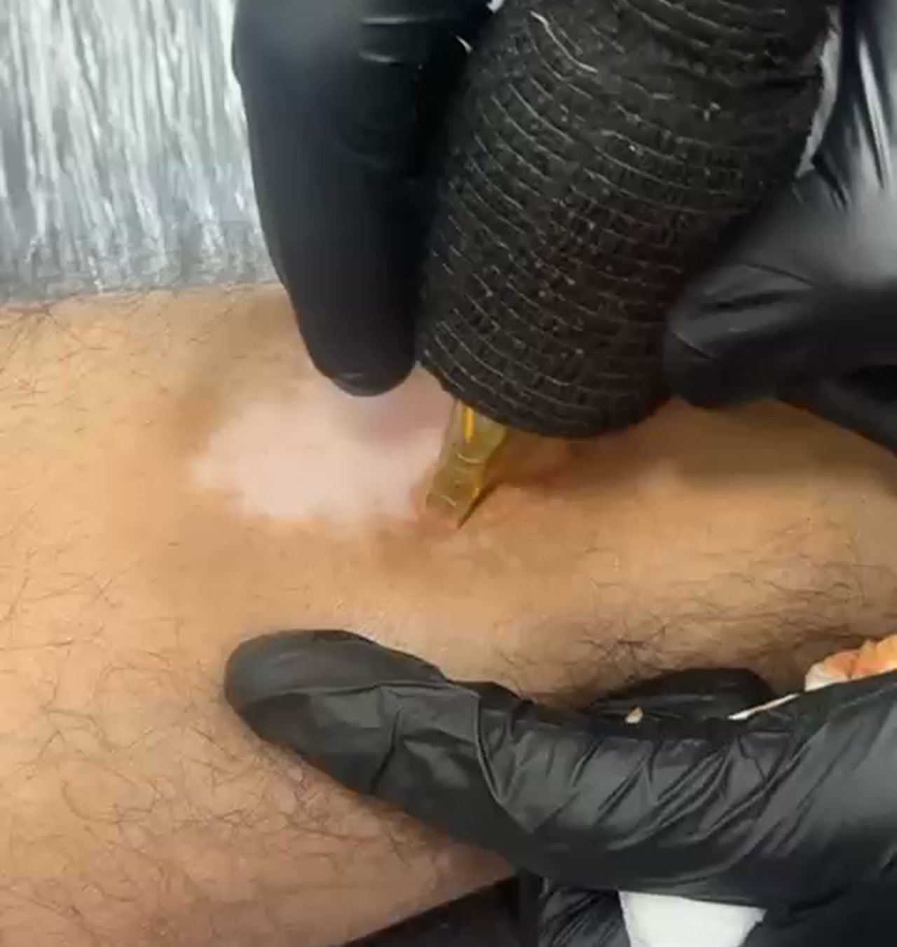 microvitiligo Facebook ad: Natural Skin Tone, Restored