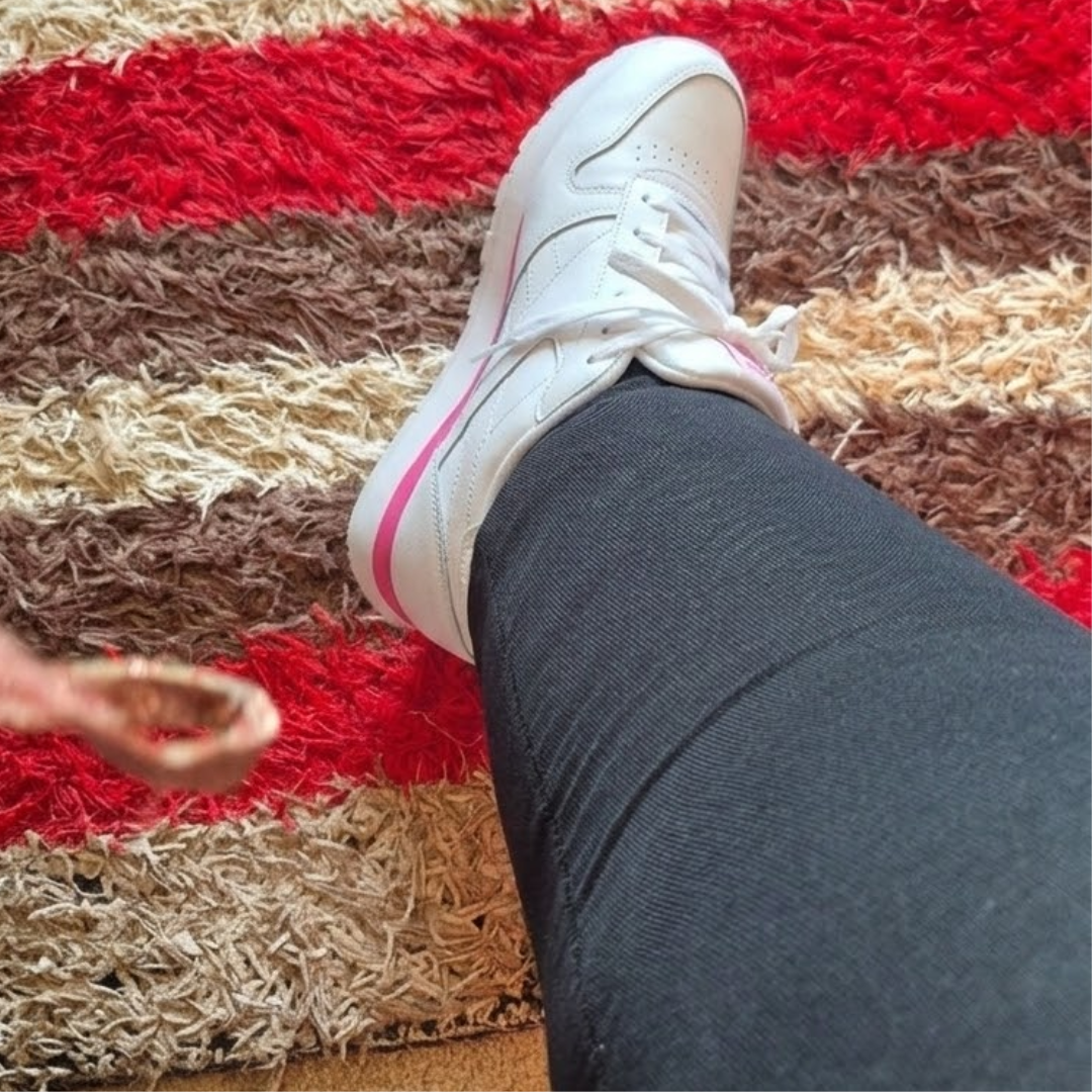 Edema Care Tips Facebook ad: She Couldn't Fit Her Shoes For 3 Years
