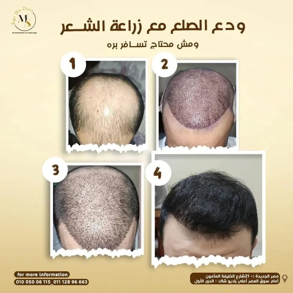 Magic skin clinics Facebook ad
