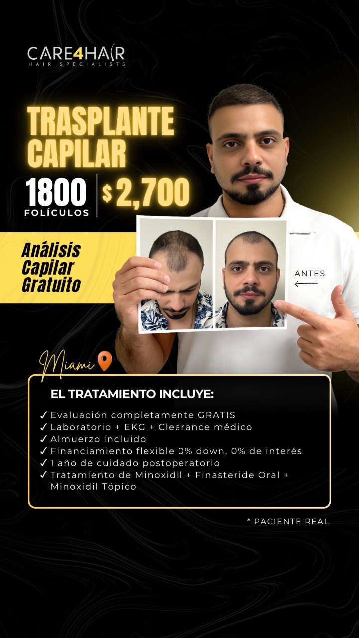 Care4Hair Facebook ad