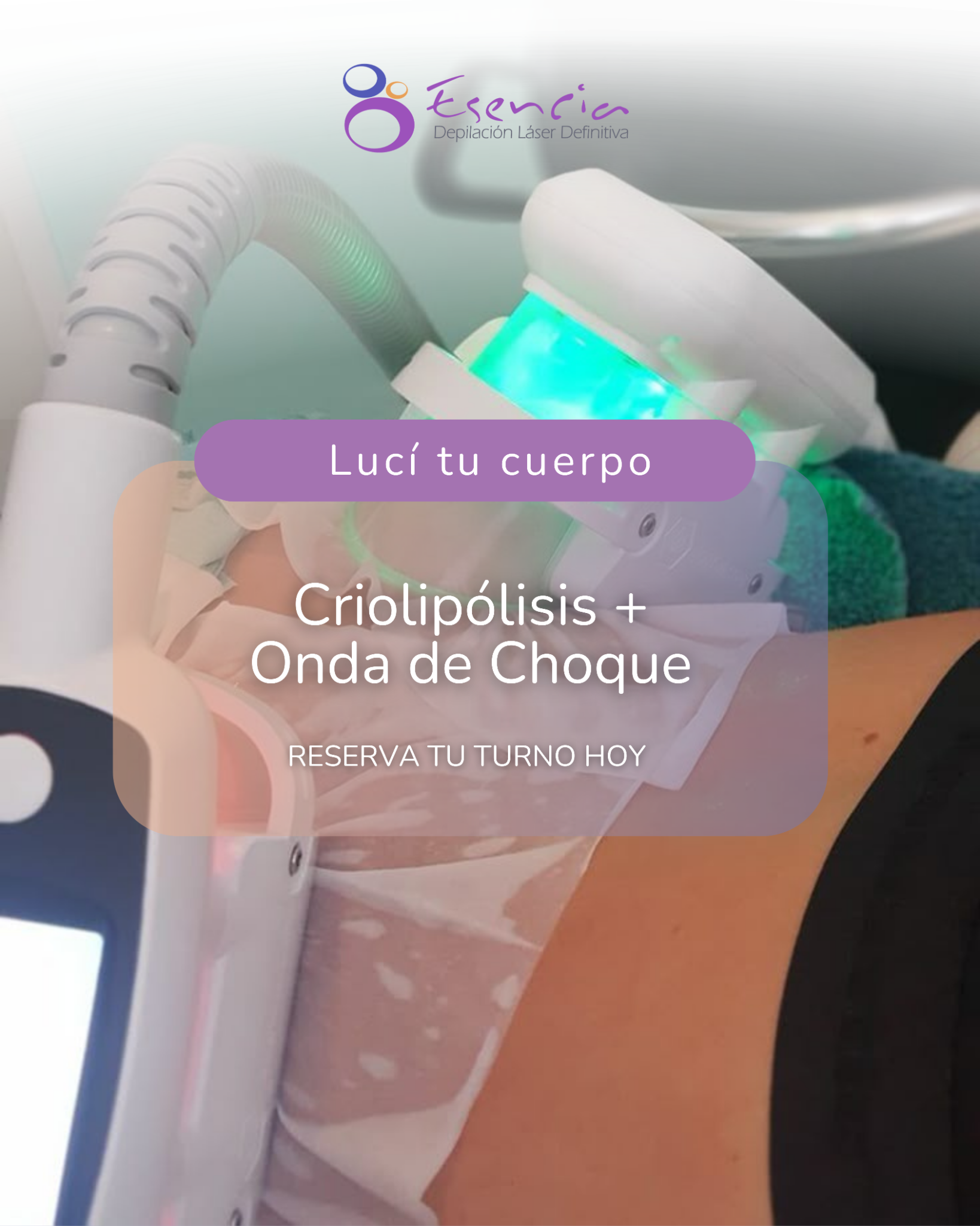 Esencia Depilación Láser Definitiva Facebook ad