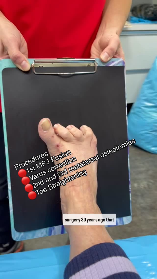 Foot First Podiatry Centers Facebook ad: Revisional surgery is always more involved than typical…