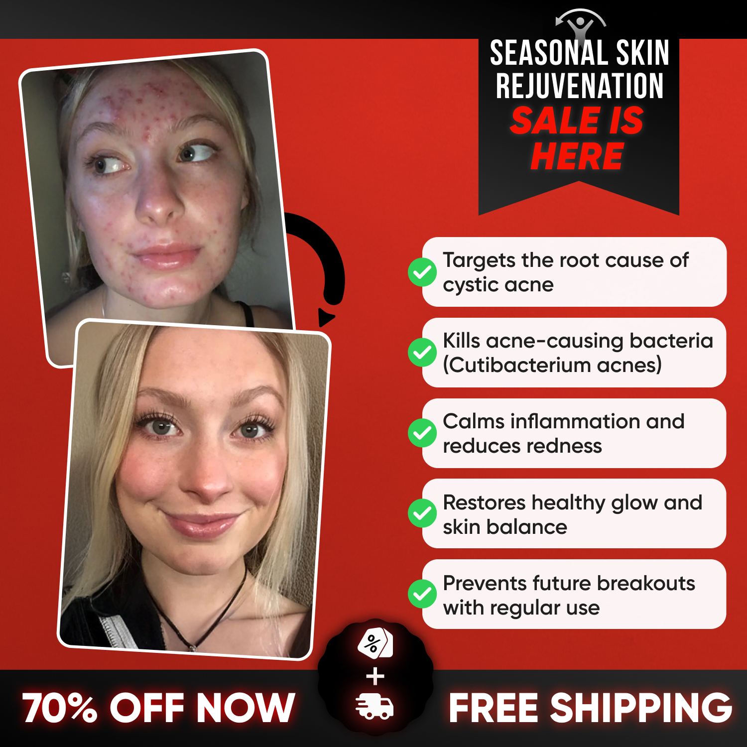 Primalderm 2.0 Facebook ad: 70% OFF + Free Shipping - Last Day!