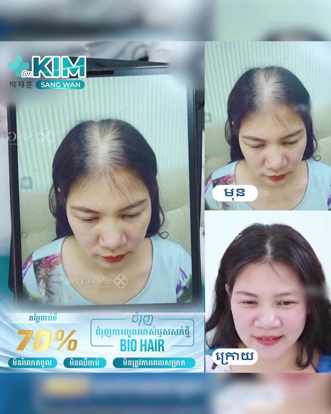 មជ្ឈមណ្ឌលកែសម្ផស្ស គីម សាំង វ័ន្ត Facebook ad: សក់ជ្រុះយូរអង្វែង, ស្តើង ហូយកាន់តែច្បាស់រាល់ថ្ងៃ?