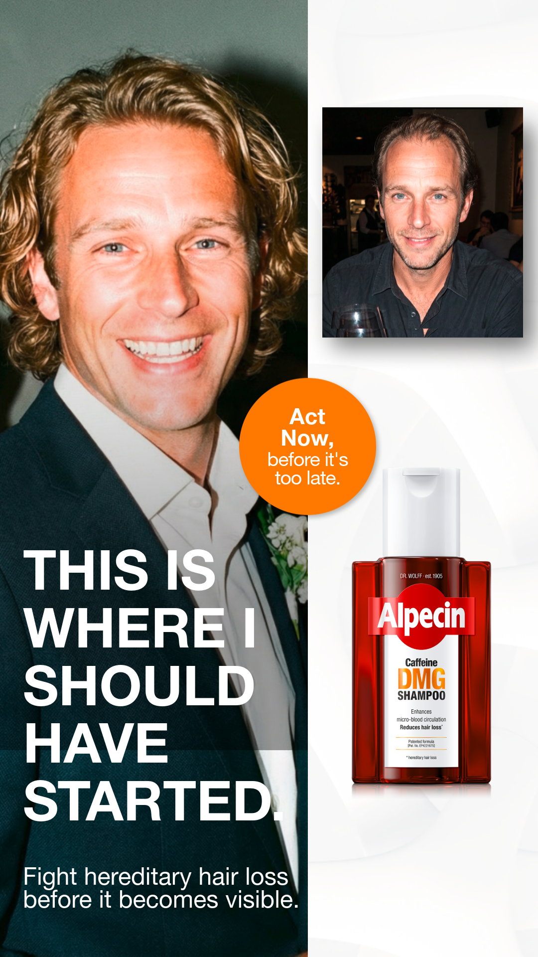 Alpecin Facebook ad