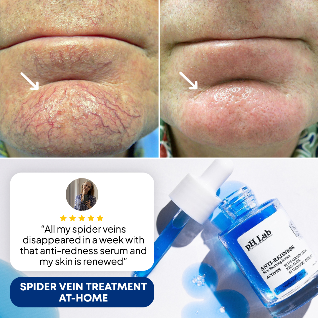 Anti-Redness US Facebook ad