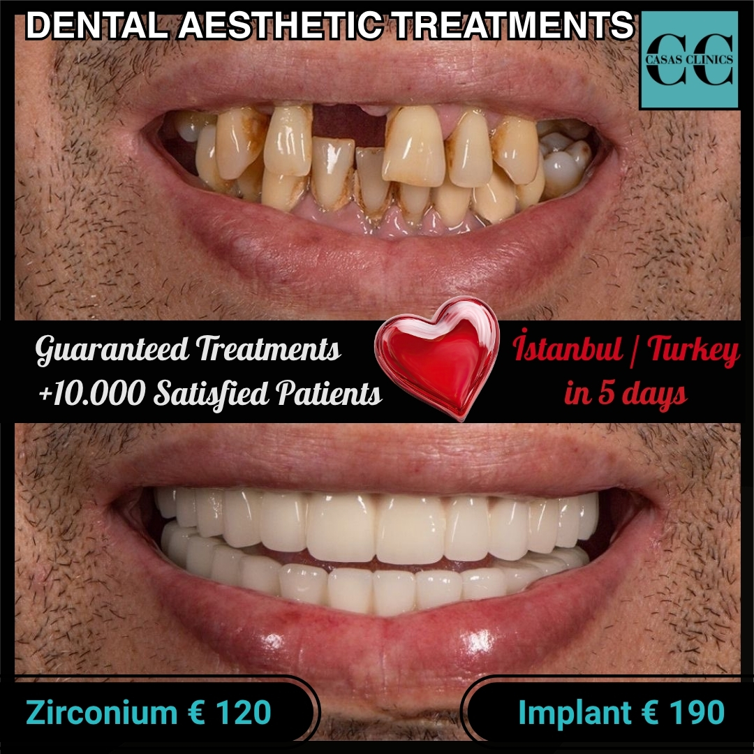 Casas Clinic Facebook ad: Fix Your Smile Now