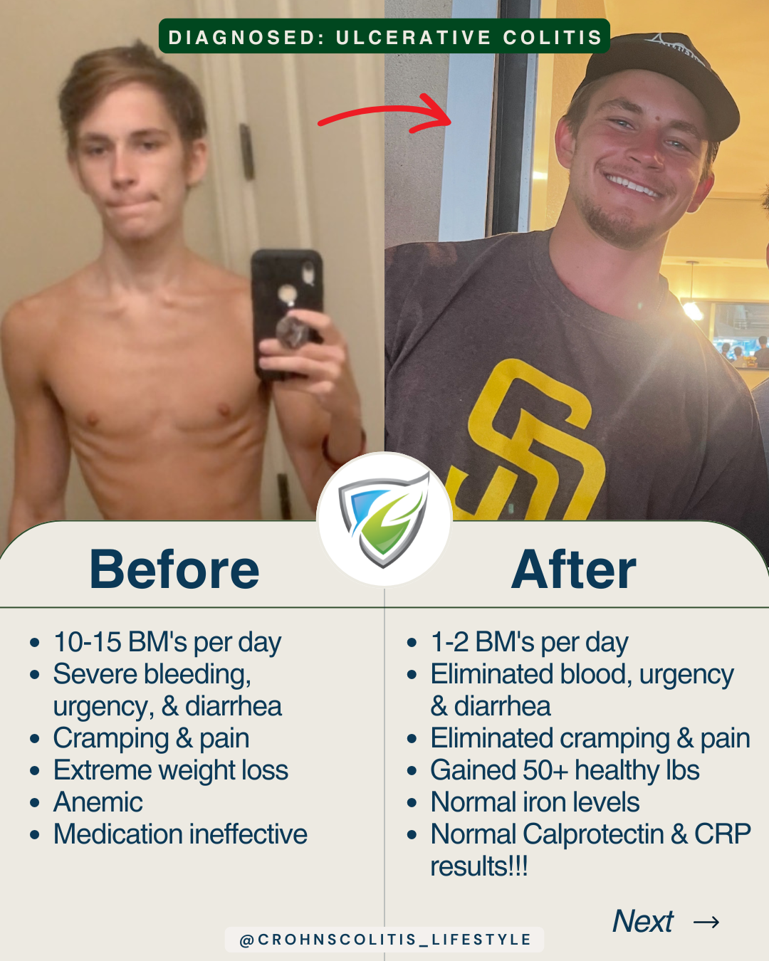 Crohn's Colitis Lifestyle Facebook ad: Are you losing weight and bleeding every day…