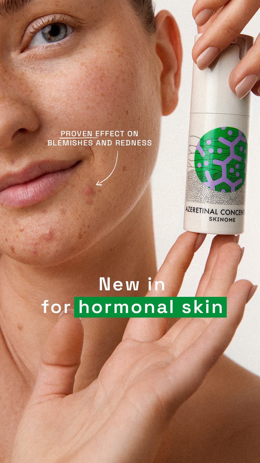 Skinome Facebook ad
