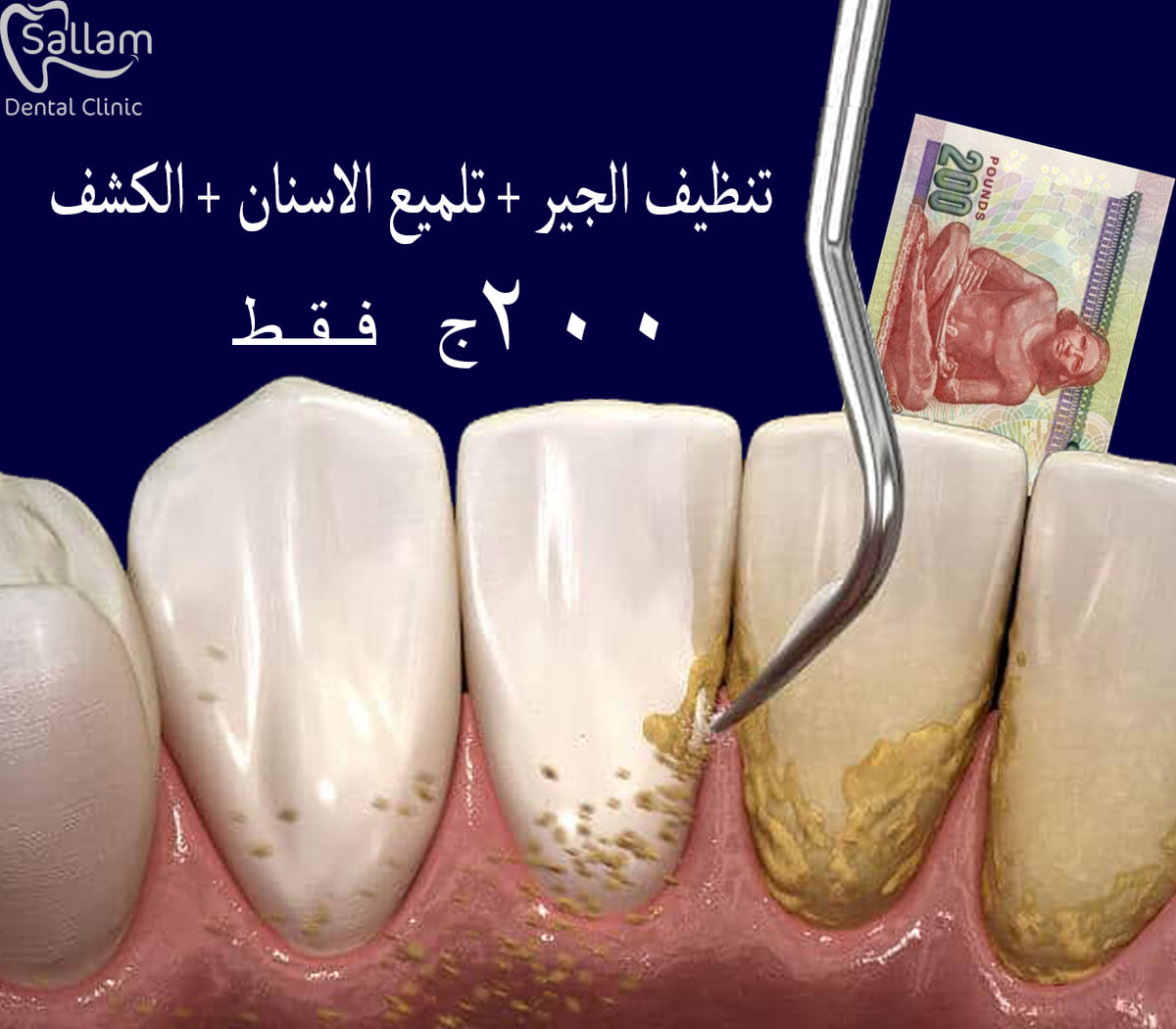 Sallam Dental Clinic Facebook ad: لكل سكان مدينه نصر والمحيطين بها