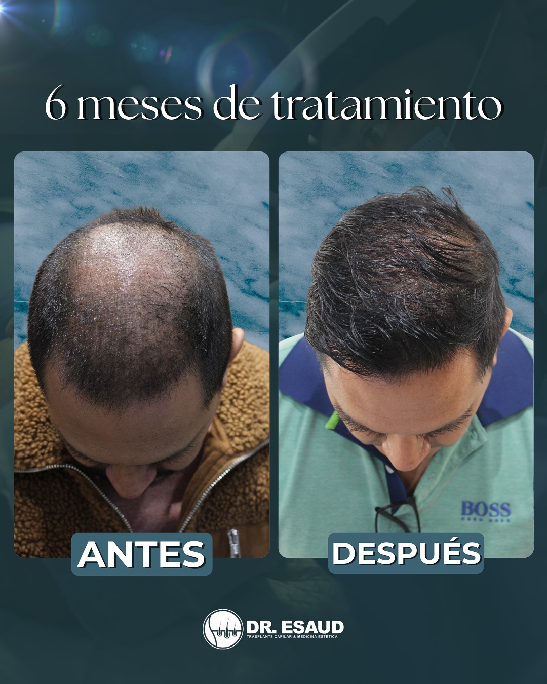 Dr. Esaud - Trasplante Capilar & Medicina Estética Facebook ad