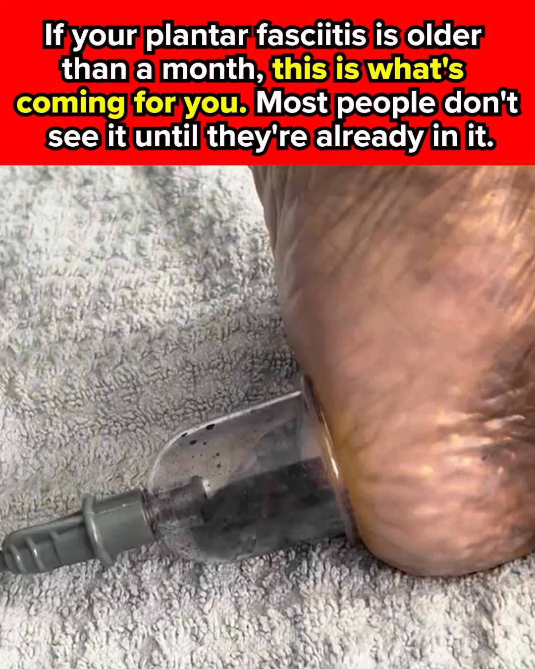 InvigorFate Facebook ad: Plantar Fasciitis Doesn't Just Hurt. It Rewrites Your…