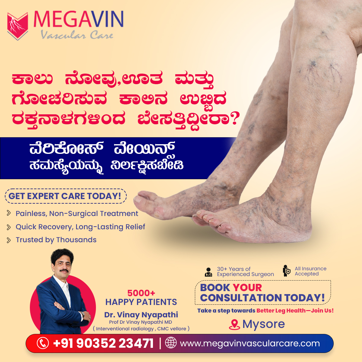 Megavin Vascular Care - Bangalore Facebook ad: Painful Legs? Laser Treatment in Mysore