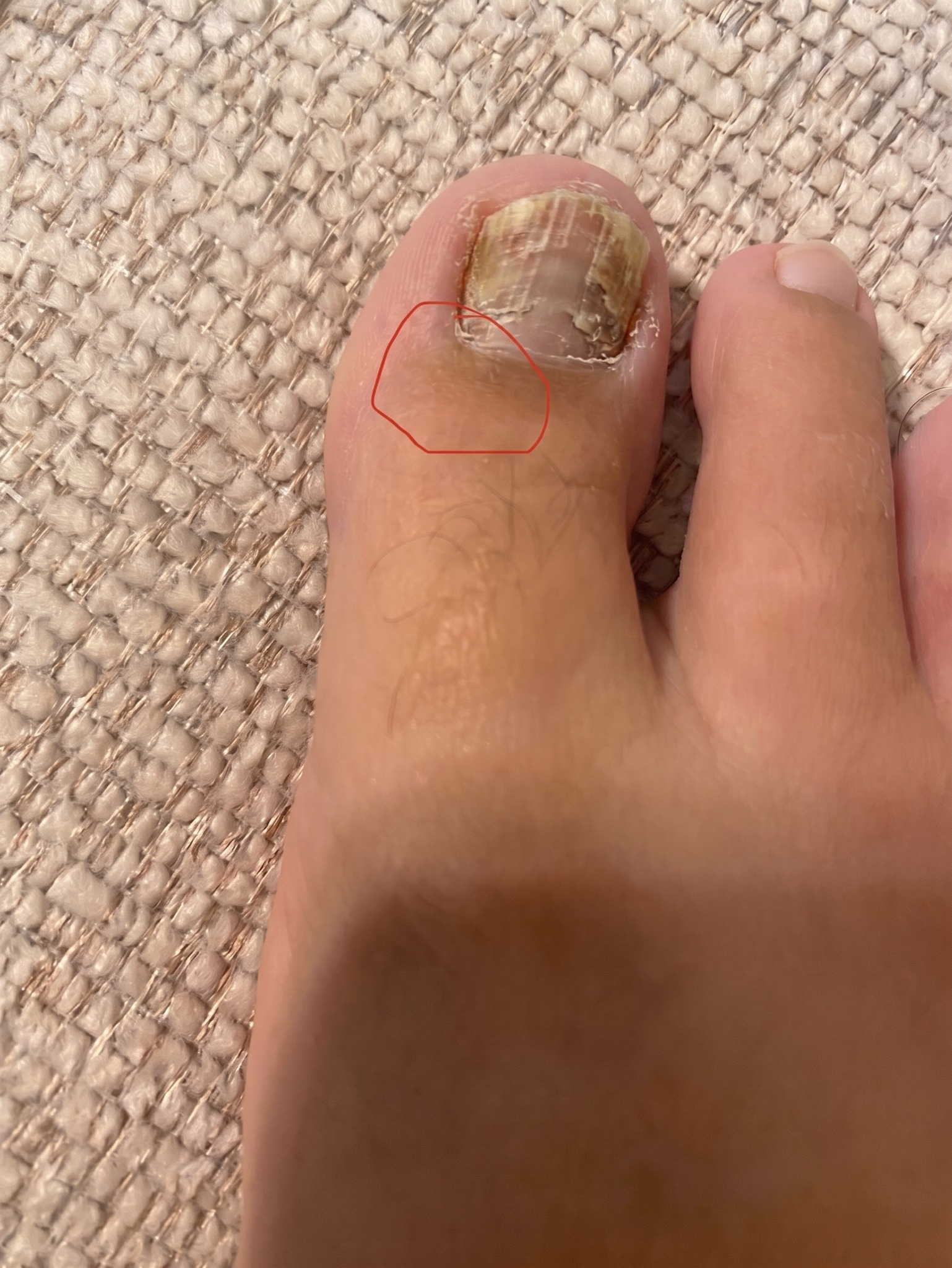 OrthoPodo Clinic Facebook ad: Si sufres de hongos en las uñas debes leer esto