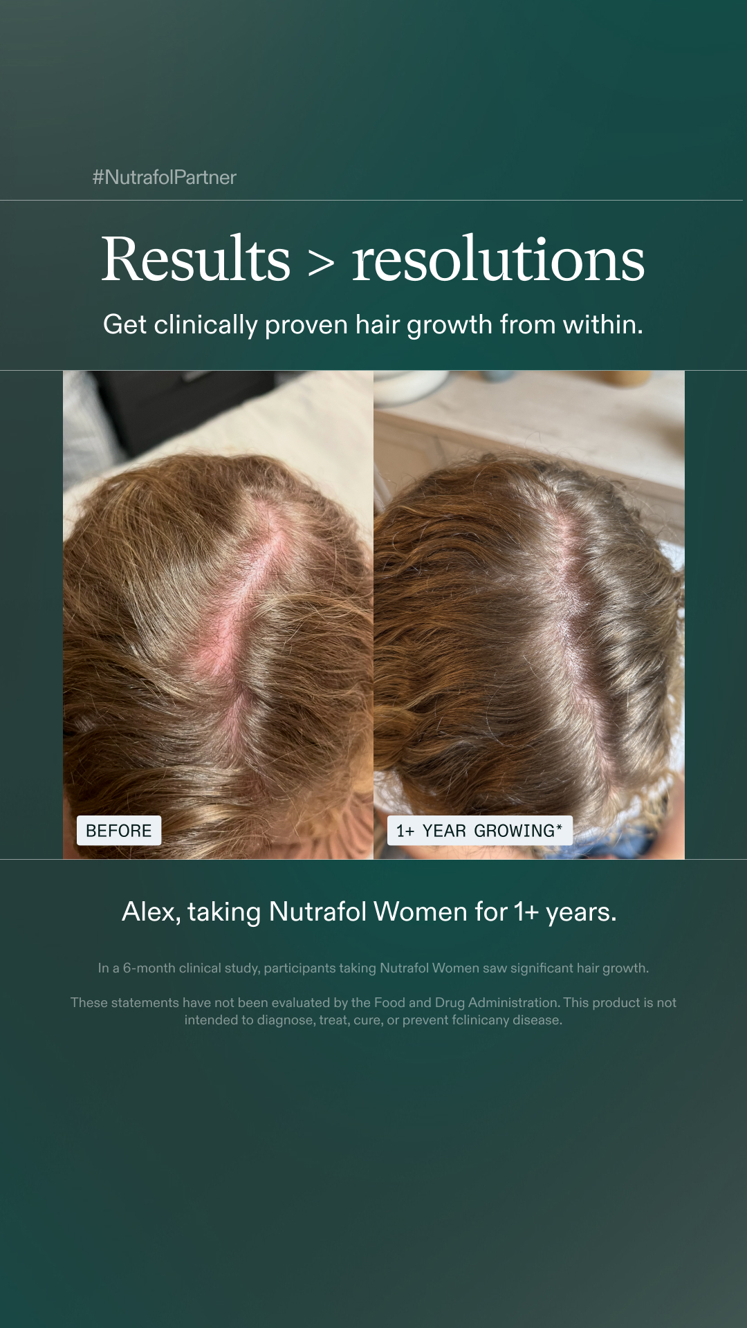 Nutrafol Facebook ad