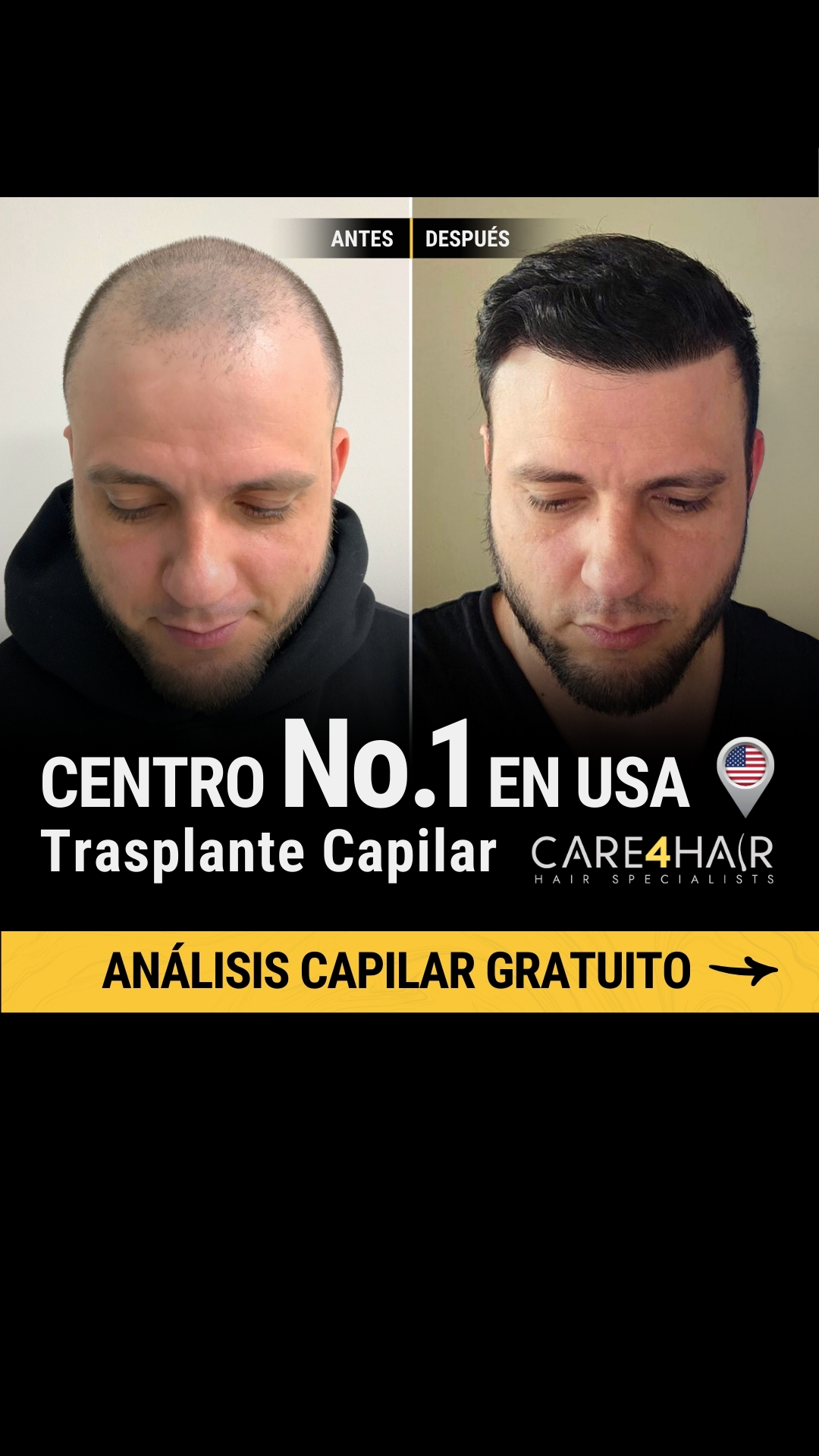 Care4Hair Facebook ad
