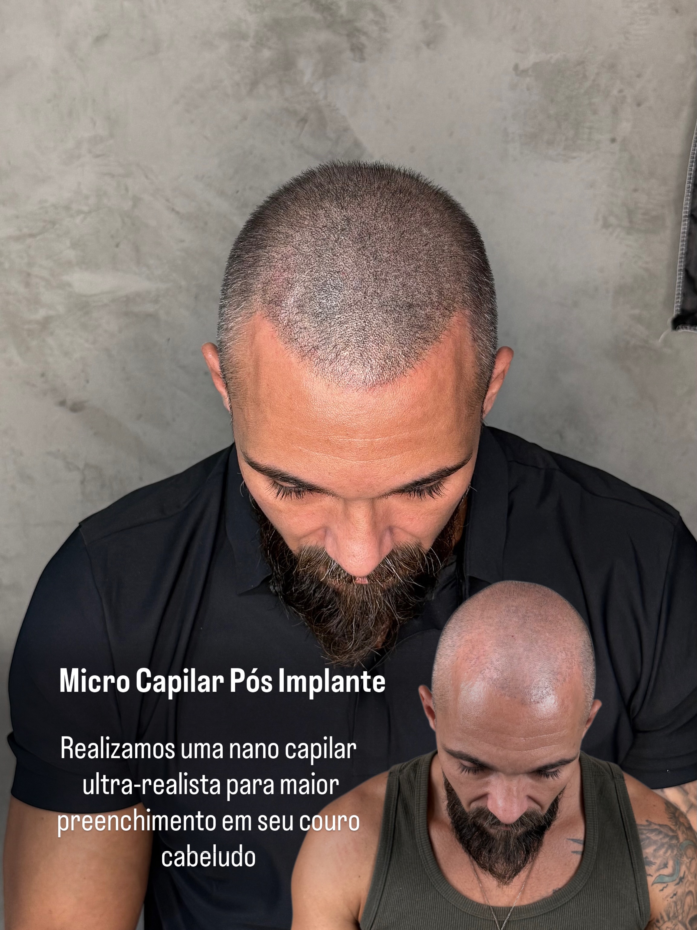Geisa Silva - Micropigmentação Capilar Facebook ad: Nano Capilar 4D, Ultra-Realista