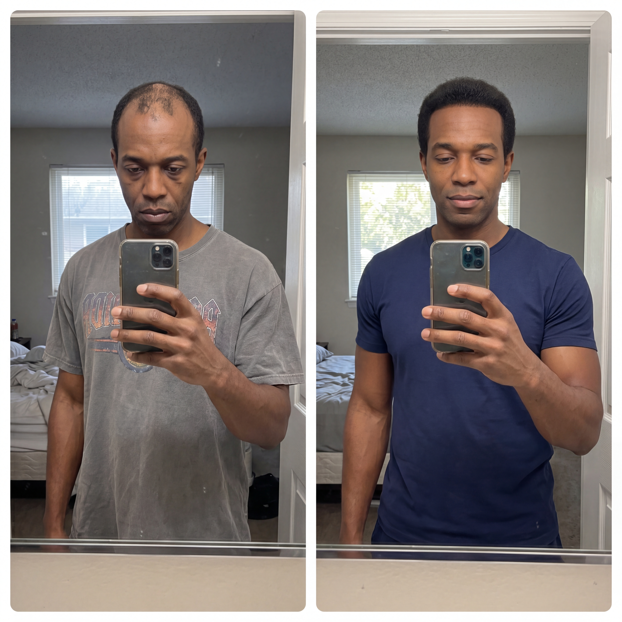 The Men's Hair Regrowth Report Facebook ad: Fix Your Hair at the Follicle Level