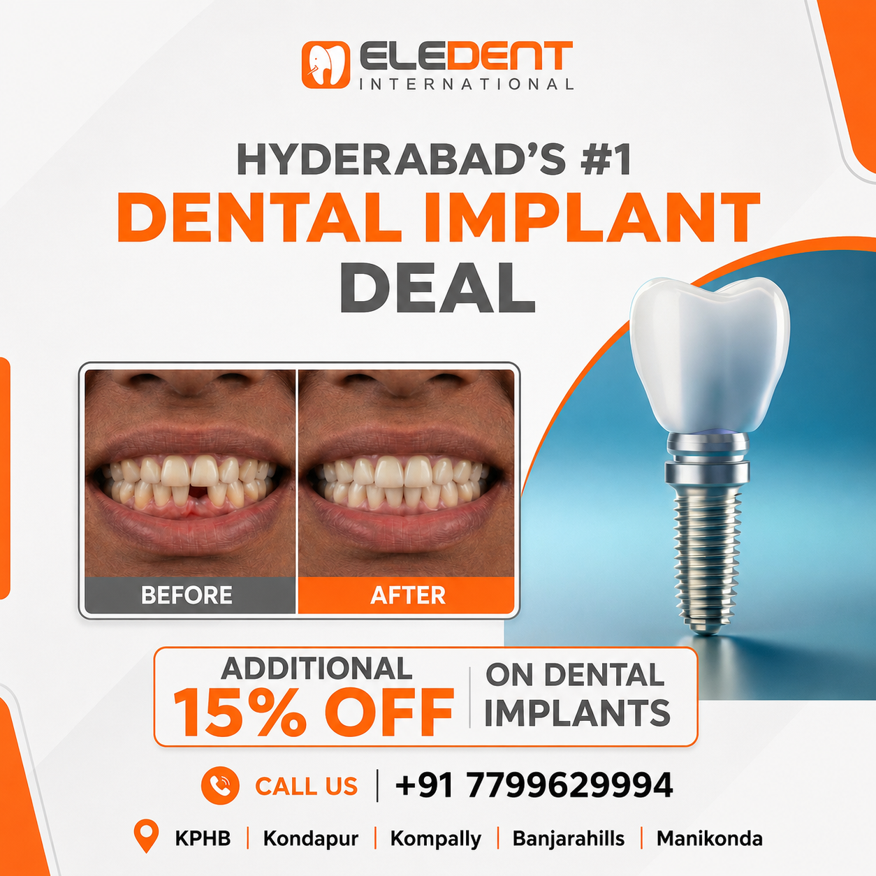 Eledent Dental Hospitals Facebook ad