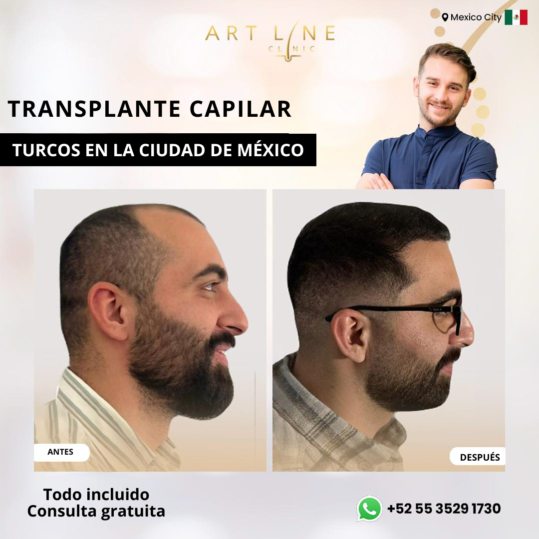 Art Line Hair Clinic CDMX Facebook ad: Agenda tu valoración
