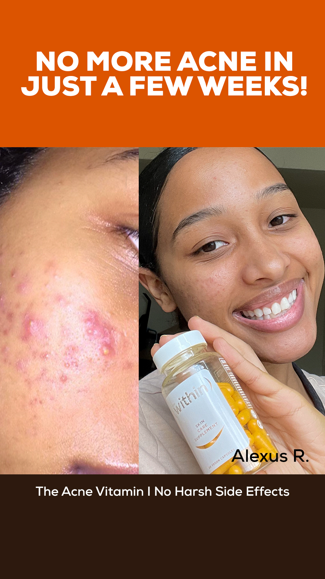 Within Skin Facebook ad