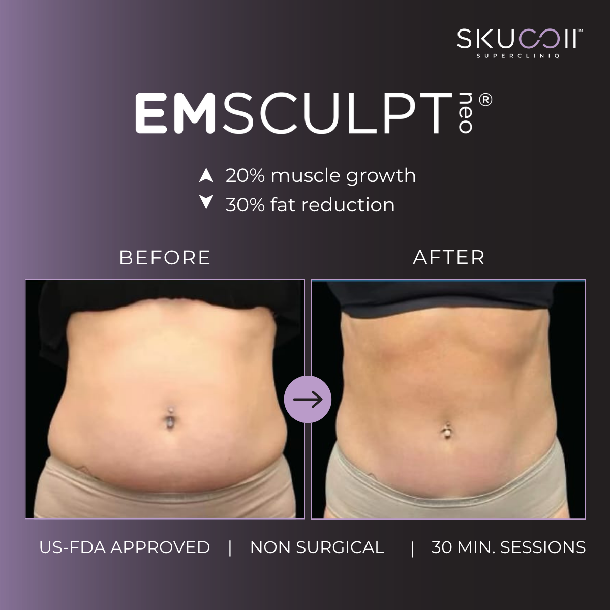 Skuccii Supercliniq  Facebook ad