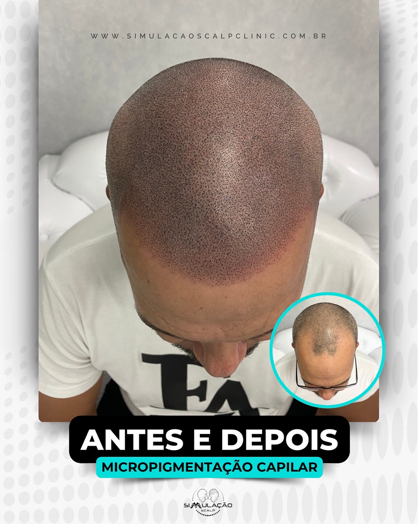 Simulação Scalp  Facebook ad
