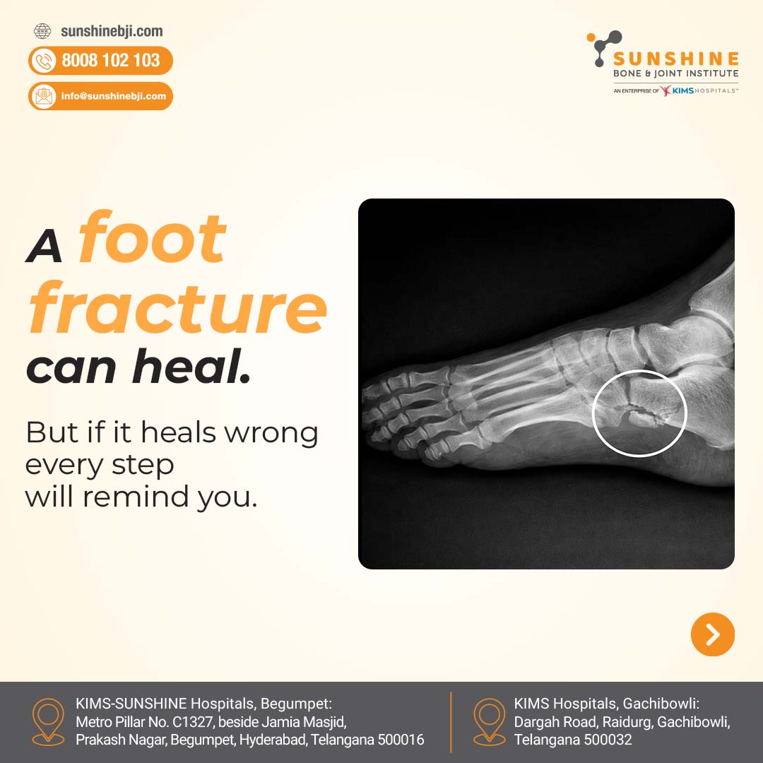 Sunshine Bone and Joint Institute Facebook ad