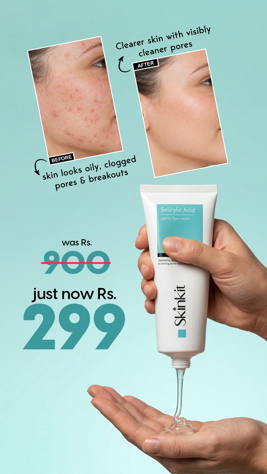 Skin Kit Facebook ad