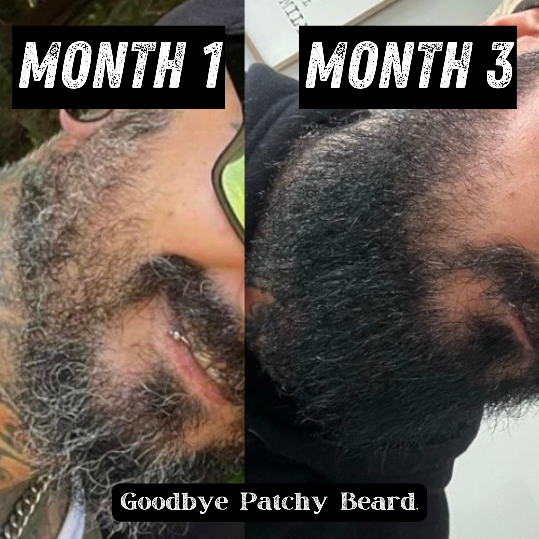 SKOL BEARD CO Facebook ad