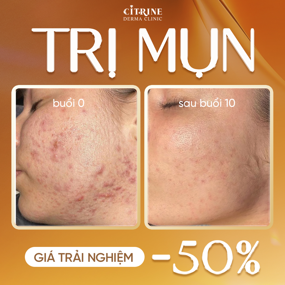 Phòng Khám Da Liễu Citrine Derma Clinic Facebook ad